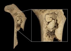 Neolithic Cannibals In Spain Ate Their Enemies As…