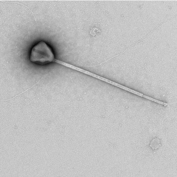 Giant Virus With Longest-Ever Tail Lurks In The…