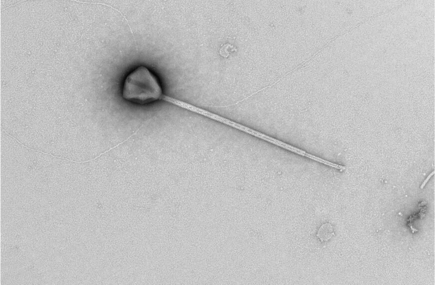 Giant Virus With Longest-Ever Tail Lurks In The Pacific Ocean