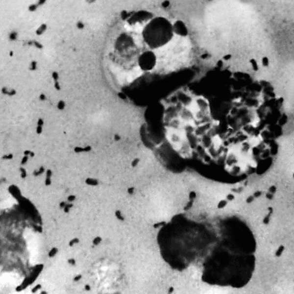 The “Plague Of Justinian” May Have Been The&hellip;