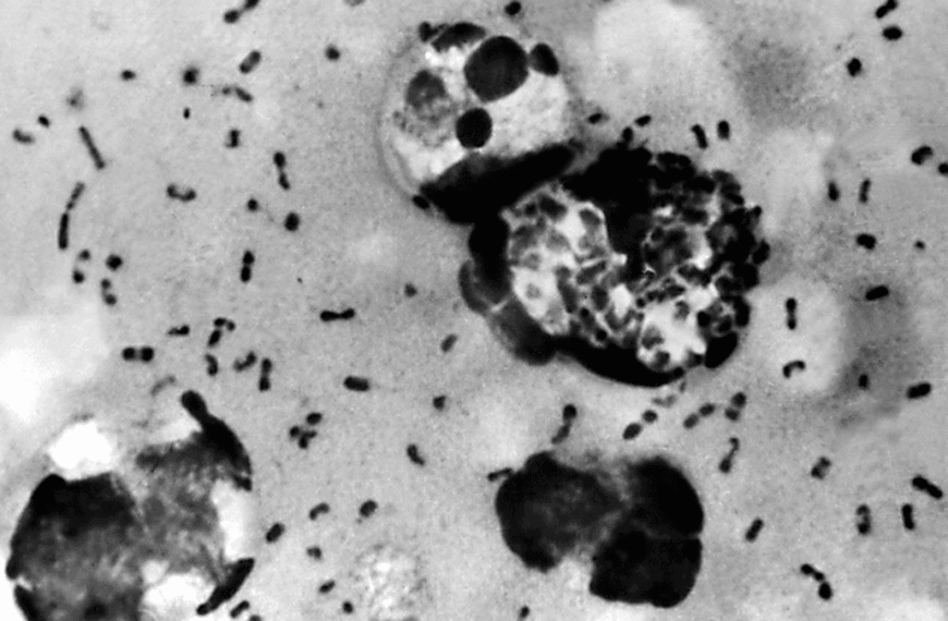 The “Plague Of Justinian” May Have Been The First Pandemic. DNA At A Mass Grave Has Finally Identified Its Cause.