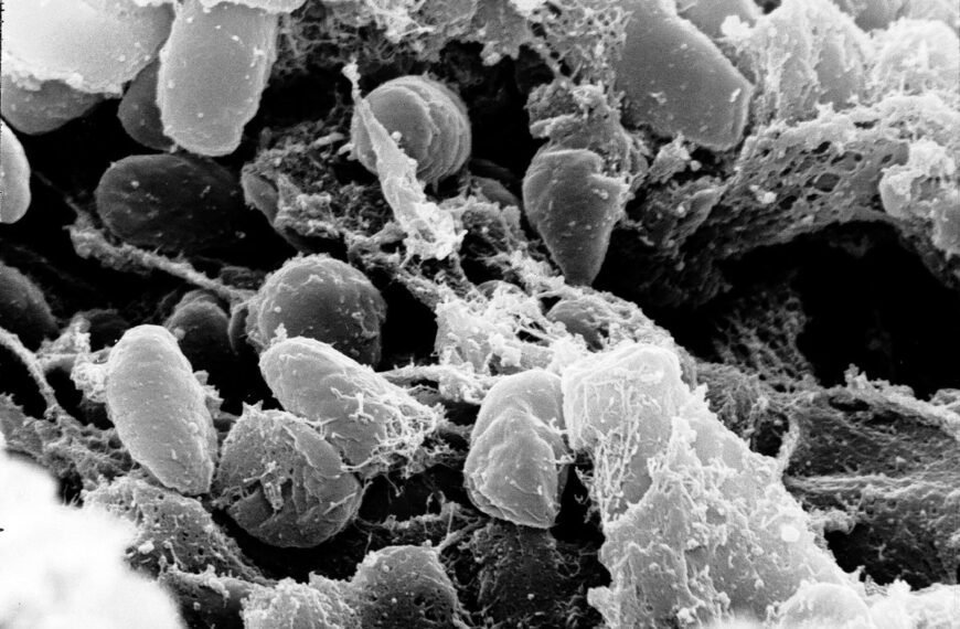 Plague Confirmed In Lake Tahoe Area For First Time In 5 Years, California Officials Say