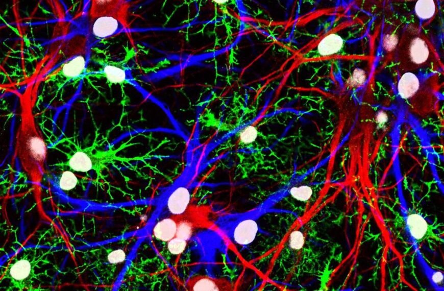 “Truly A Reversal”: Scientists Find Protein That Causes Brain Aging, And Learn How To Stop It