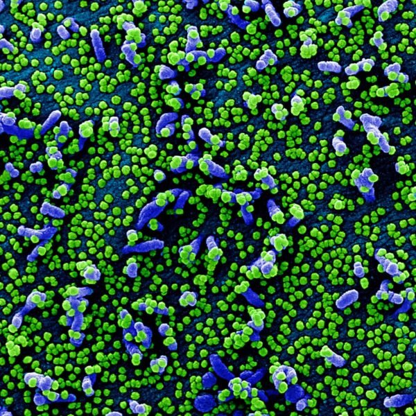 What Are The Symptoms Of The “Stratus” COVID-19&hellip;