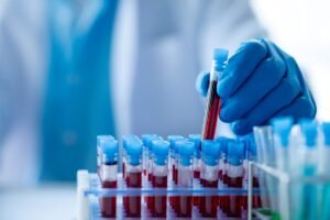 New Blood Test Offers Potential For “Simple, Accurate”&hellip;