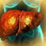 First Targeted Treatment For Dangerous Liver Disease Could Come From An Unexpected Source