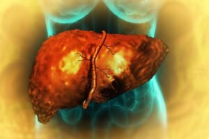 First Targeted Treatment For Dangerous Liver Disease Could…