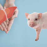 First-Ever Living Recipient Of A Pig-To-Human Liver Transplant Survived For 171 Days