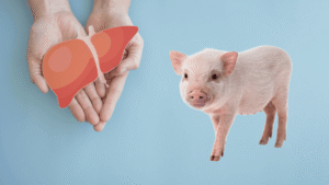 First-Ever Living Recipient Of A Pig-To-Human Liver Transplant&hellip;