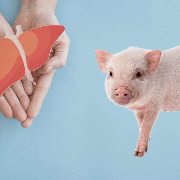 First-Ever Living Recipient Of A Pig-To-Human Liver Transplant&hellip;
