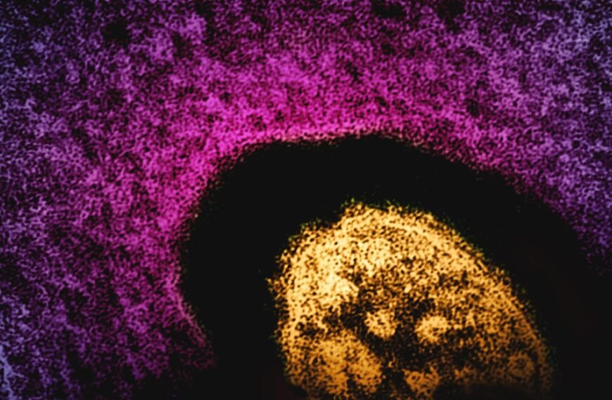 US Breaks New Measles Record, Surpassing 1,500 Cases…