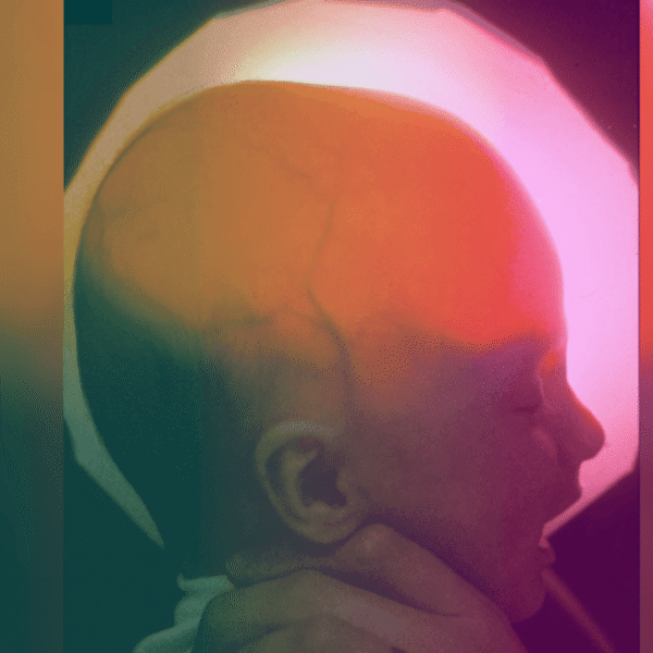 A Woman Born Missing Most Of Her Brain&hellip;