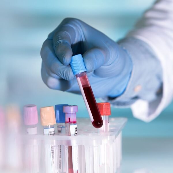 This Newly Discovered Blood Type Is So Rare,&hellip;