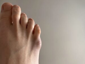 The Pinky Toe Has A Purpose And Most&hellip;