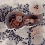 Ancient Genomes From 2,500-Year-Old-Skeleton Offer First Proof Of Humanity’s Long History With Herpes