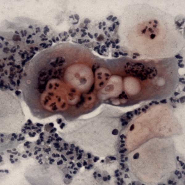 Ancient Genomes From 2,500-Year-Old-Skeleton Offer First Proof Of&hellip;